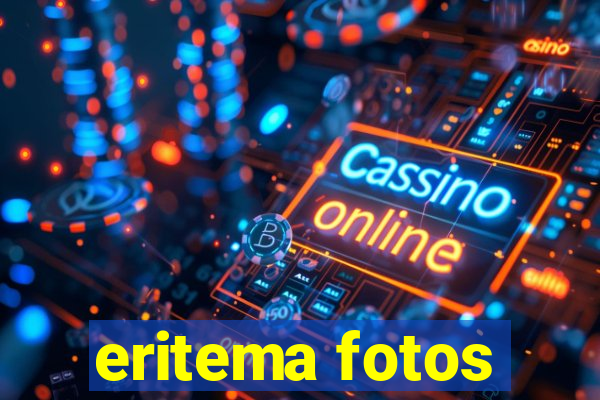 eritema fotos